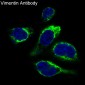 Anti-Vimentin Rabbit Monoclonal Antibody
